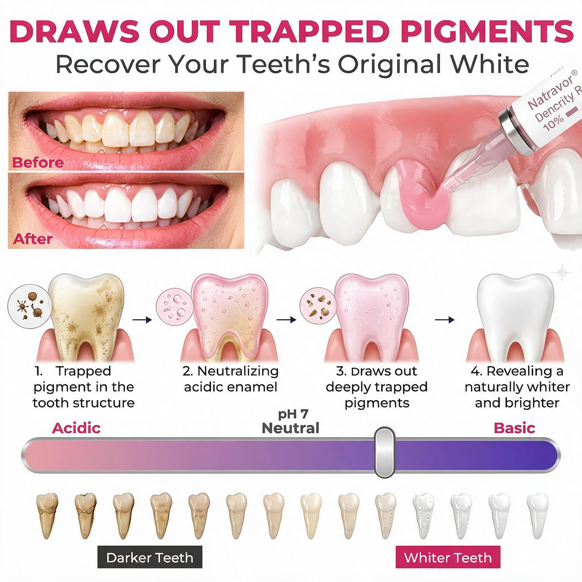 Natravor® DenPerm Cavity-Repair Natural Enamel Filling Gel