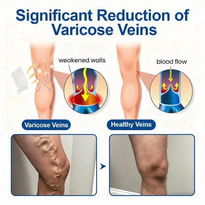 🇺🇸👨‍⚕️✅Natravor®  VeinEase Microneedle Care Patch⚡Instant Relief, Long-Term Results