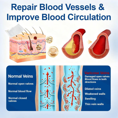 🇺🇸👨‍⚕️✅Natravor®  VeinEase Microneedle Care Patch⚡Instant Relief, Long-Term Results