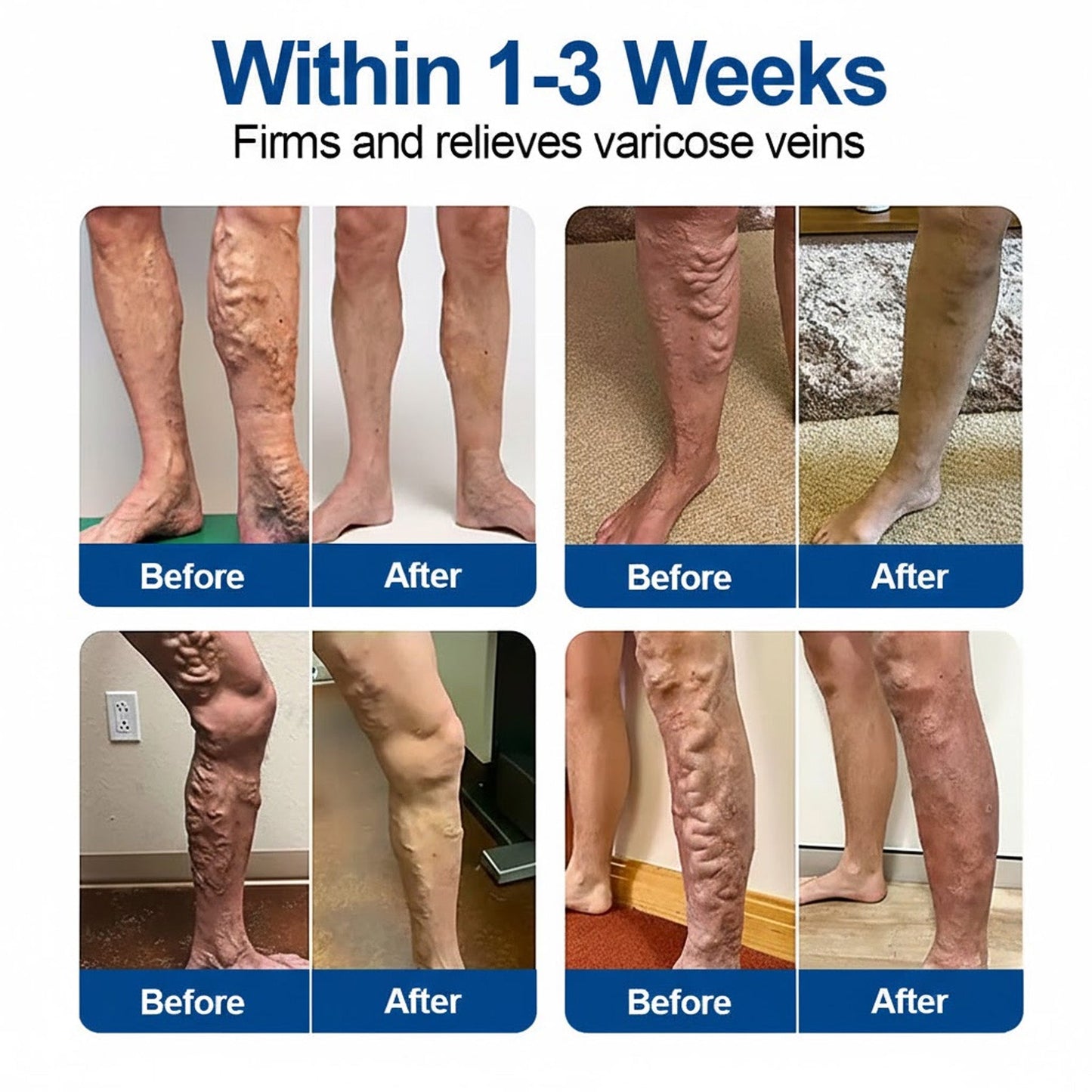 🇺🇸👨‍⚕️✅Natravor®  VeinEase Microneedle Care Patch⚡Instant Relief, Long-Term Results