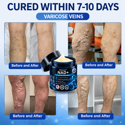 Official Store:  🦵𝐍𝐚𝐭𝐫𝐚𝐯𝐨𝐫™ NAD+ Advanced Anti-Aging Joint Relief Cre am (Specially for mature adults & recommended for daily joint care)🔥𝑳𝒂𝒔𝒕 𝒅𝒂𝒚 𝒑𝒓𝒐𝒎𝒐𝒕𝒊𝒐𝒏 7𝟎% 𝒐𝒇𝒇